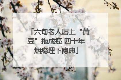 六旬老人唇上“黄豆”拖成癌 四十年烟瘾埋下隐患